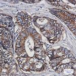 HSPE1 Recombinant Rabbit Monoclonal Antibody (K01_1P78)