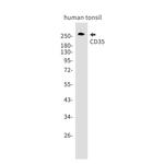 CD35 Antibody in Western Blot (WB)