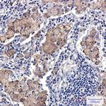 SMN1 Recombinant Rabbit Monoclonal Antibody (K01_1R60)