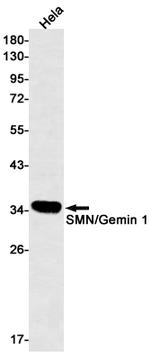 SMN1 Antibody in Western Blot (WB)