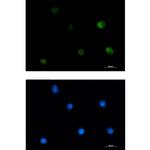 PKC beta Recombinant Rabbit Monoclonal Antibody (K01_1W82)