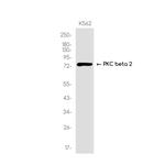 PKC beta Antibody in Western Blot (WB)