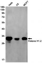 Histone H1.2 Recombinant Rabbit Monoclonal Antibody (K01_1S16)