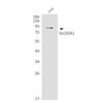 SLCO5A1 Antibody in Western Blot (WB)