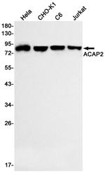 ACAP2 Recombinant Rabbit Monoclonal Antibody (K01_1P49)