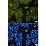 MTCO2 Recombinant Rabbit Monoclonal Antibody (K01_1U15)