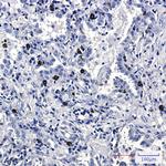 FLI1 Antibody in Immunohistochemistry (Paraffin) (IHC (P))