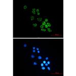 PUS1 Recombinant Rabbit Monoclonal Antibody (K01_1X37)