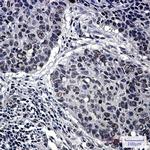 HP1 gamma Recombinant Rabbit Monoclonal Antibody (K01_1S48)