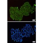 DPYD Recombinant Rabbit Monoclonal Antibody (K01_1Q55)