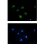 PCK2 Recombinant Rabbit Monoclonal Antibody (K01_1W43)