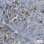 TAP Antibody in Immunohistochemistry (Paraffin) (IHC (P))