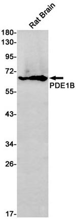 PDE1B Recombinant Rabbit Monoclonal Antibody (K01_1W46)