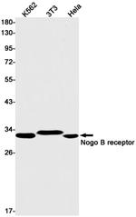 NUS1 Recombinant Rabbit Monoclonal Antibody (K01_1U84)