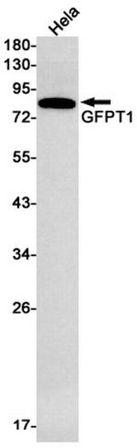 GFPT1 Antibody in Western Blot (WB)