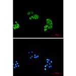PSMA6 Recombinant Rabbit Monoclonal Antibody (K01_1X18)