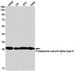 PSMA6 Antibody in Western Blot (WB)