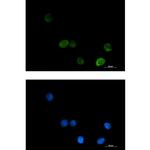 MTHFR Recombinant Rabbit Monoclonal Antibody (K01_1U19)