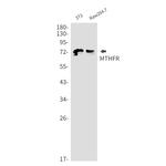 MTHFR Antibody in Western Blot (WB)