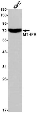 MTHFR Antibody in Western Blot (WB)