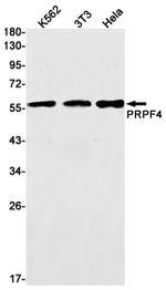 PRPF4 Recombinant Rabbit Monoclonal Antibody (K01_1X22)