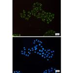 REA Recombinant Rabbit Monoclonal Antibody (K01_1X71)