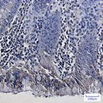 REA Antibody in Immunohistochemistry (Paraffin) (IHC (P))