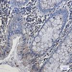 EHD1 Antibody in Immunohistochemistry (Paraffin) (IHC (P))