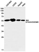 DFNA5 Recombinant Rabbit Monoclonal Antibody (K01_1Q36)