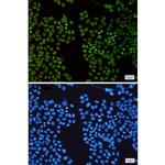 HMGA1 Recombinant Rabbit Monoclonal Antibody (K01_1S31)