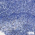 HMGA1 Antibody in Immunohistochemistry (Paraffin) (IHC (P))