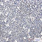 IKAROS Recombinant Rabbit Monoclonal Antibody (K01_1S75)