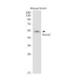NOVA1 Recombinant Rabbit Monoclonal Antibody (K01_1U87)