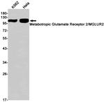 mGluR2 Antibody in Western Blot (WB)