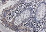 GOT2 Antibody in Immunohistochemistry (Paraffin) (IHC (P))
