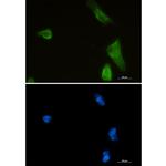 IKK beta Recombinant Rabbit Monoclonal Antibody (K01_1S80)