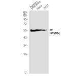 PPP2R5E Antibody in Western Blot (WB)