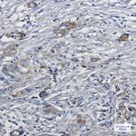 MYO1B Recombinant Rabbit Monoclonal Antibody (K01_1U37)