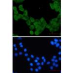 Kinesin 5B Recombinant Rabbit Monoclonal Antibody (K01_1T27)