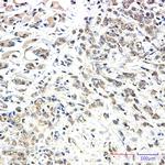 Kinesin 5B Antibody in Immunohistochemistry (Paraffin) (IHC (P))