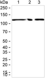 Kinesin 5B Antibody in Western Blot (WB)