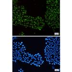 RAB7 Recombinant Rabbit Monoclonal Antibody (K01_1X44)