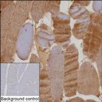 RAB7 Antibody in Immunohistochemistry (Paraffin) (IHC (P))