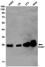 RAB7 Antibody in Western Blot (WB)