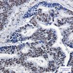 SP1 Antibody in Immunohistochemistry (Paraffin) (IHC (P))