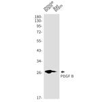 PDGF-B Recombinant Rabbit Monoclonal Antibody (K01_1W47)