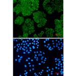 Fumarase Recombinant Rabbit Monoclonal Antibody (K01_1R15)