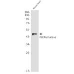 Fumarase Antibody in Western Blot (WB)