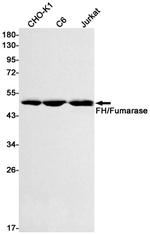 Fumarase Antibody in Western Blot (WB)