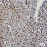 CIRBP Recombinant Rabbit Monoclonal Antibody (K01_1P59)